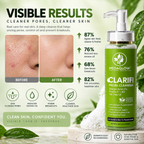 Clarifi Anti Acne Facial Cleanser| For Sensitive Skin Also