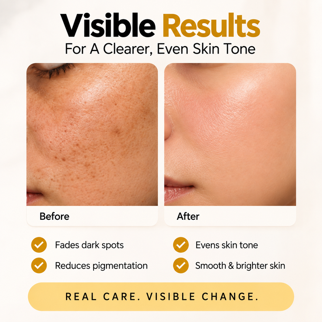 MEDAGLOW Anti Dark Spot Night Cream – Anti Pigmentation Treatment