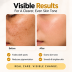 MEDAGLOW Anti Dark Spot Night Cream – Anti Pigmentation Treatment
