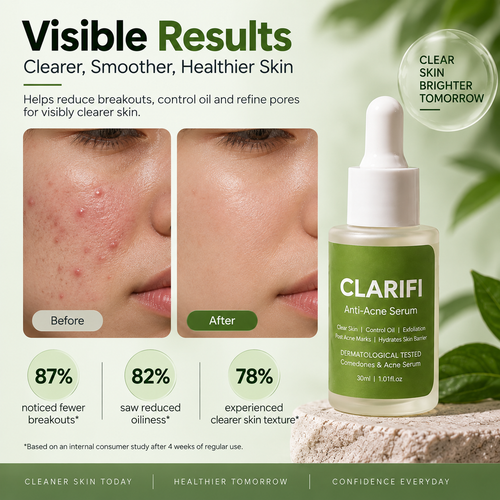 Clarifii Anti Acne Serum| For Sensitive Skin Also