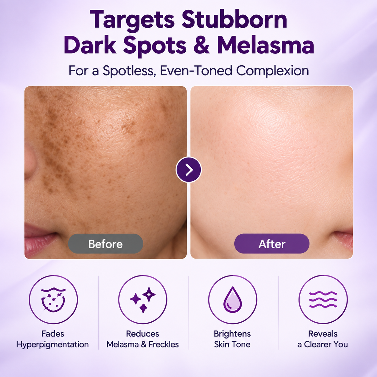 Spot Less Hyperpigmentation and Freckle Serum