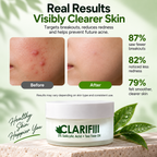 Medaglow Acne Solution Night Routine